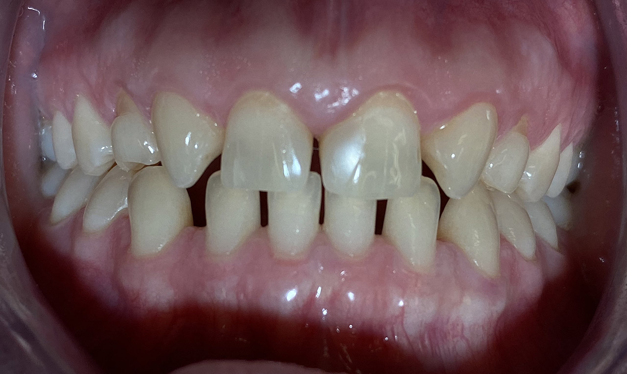 Ästhetische Zahnheilkunde / 02