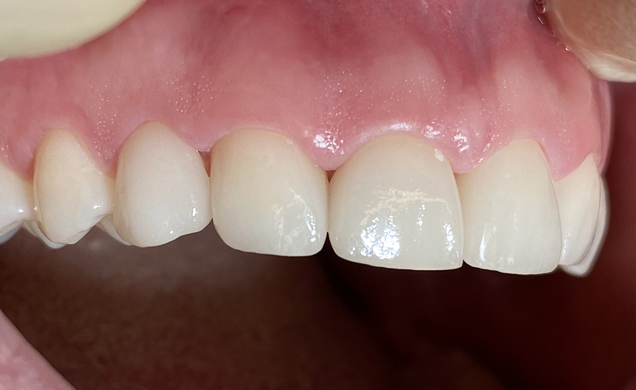 Ästhetische Zahnheilkunde / 07